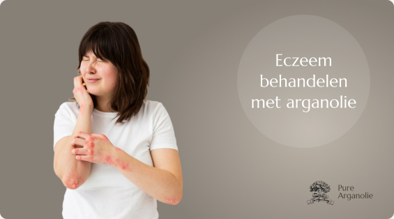 Eczeem behandelen met arganolie